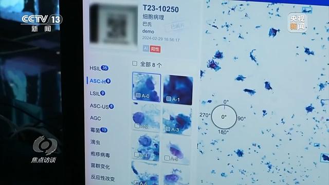 焦點(diǎn)訪談丨輔助診斷、AI問答、健康管理……AI正重塑醫(yī)療服務(wù)鏈條